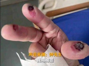 三根手指头解决不了的问题，我们有专业的产品