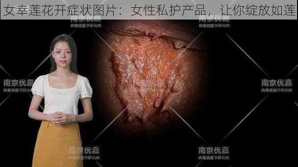 女幸莲花开症状图片：女性私护产品，让你绽放如莲