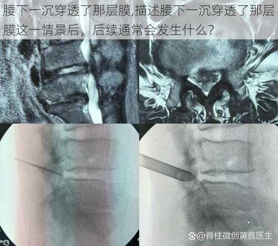 腰下一沉穿透了那层膜,描述腰下一沉穿透了那层膜这一情景后，后续通常会发生什么？