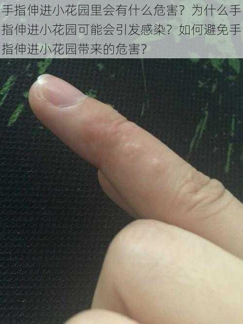 手指伸进小花园里会有什么危害？为什么手指伸进小花园可能会引发感染？如何避免手指伸进小花园带来的危害？